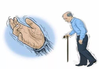 帕金森。芭痢辈慌？