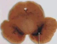 正常人：正：谥