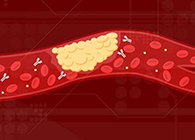 【Science速递】攻克COVID-19里程碑：已确定血凝块形成原因！