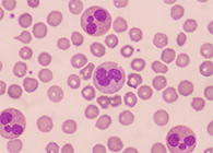 一种神秘颗粒被发现了！它能否成为败血症早筛标志物？