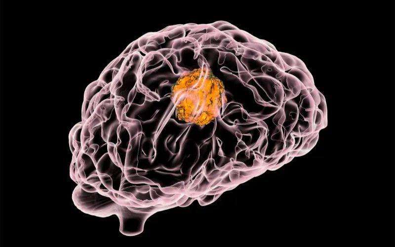 HJC黄金城平台助力 | 璧辰医药ABM-1310获美国FDA孤儿药资格认证，用于治疗携带BRAF V600突变的脑胶质母细胞瘤患者